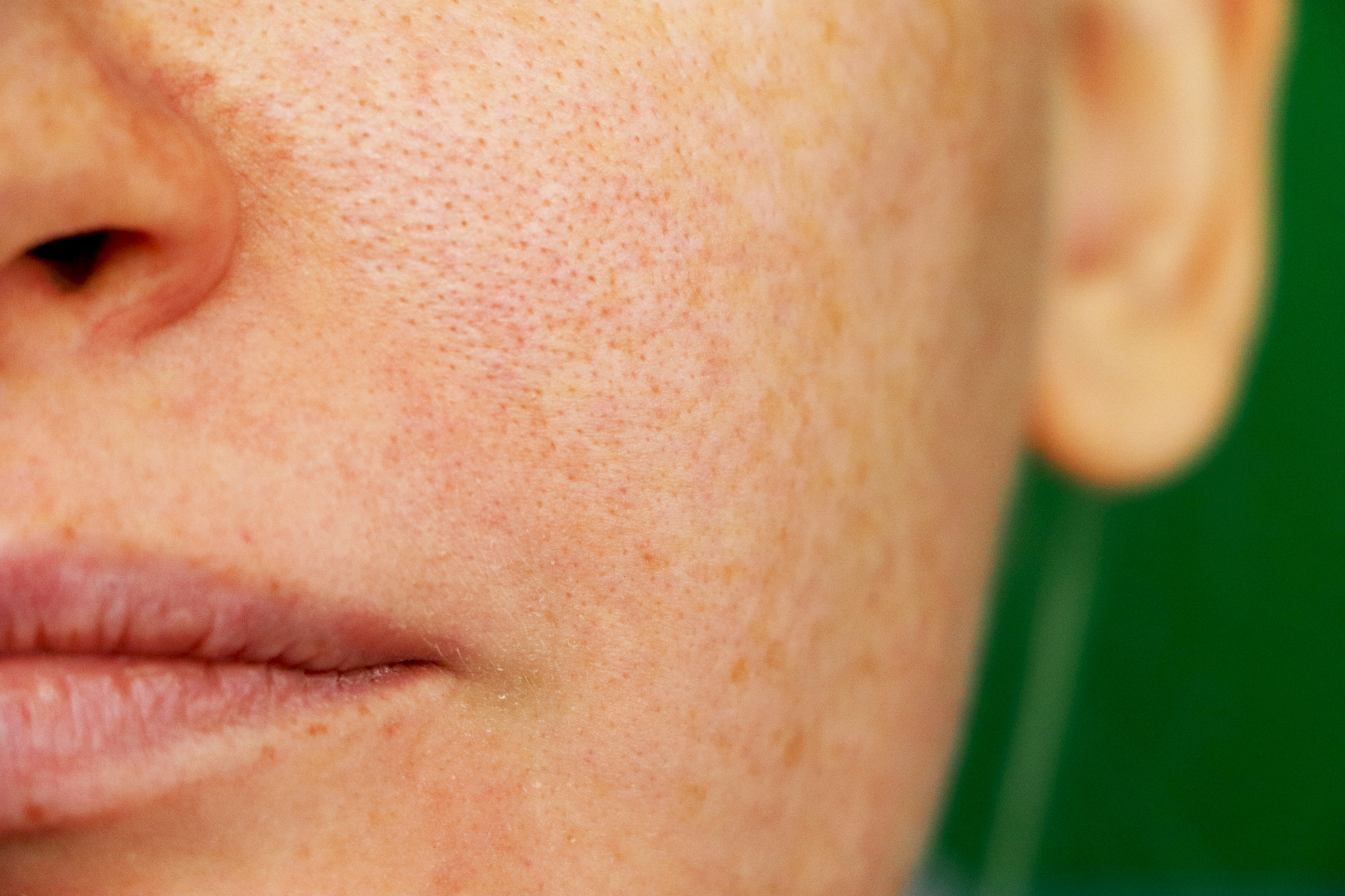 The Truth about your Pores